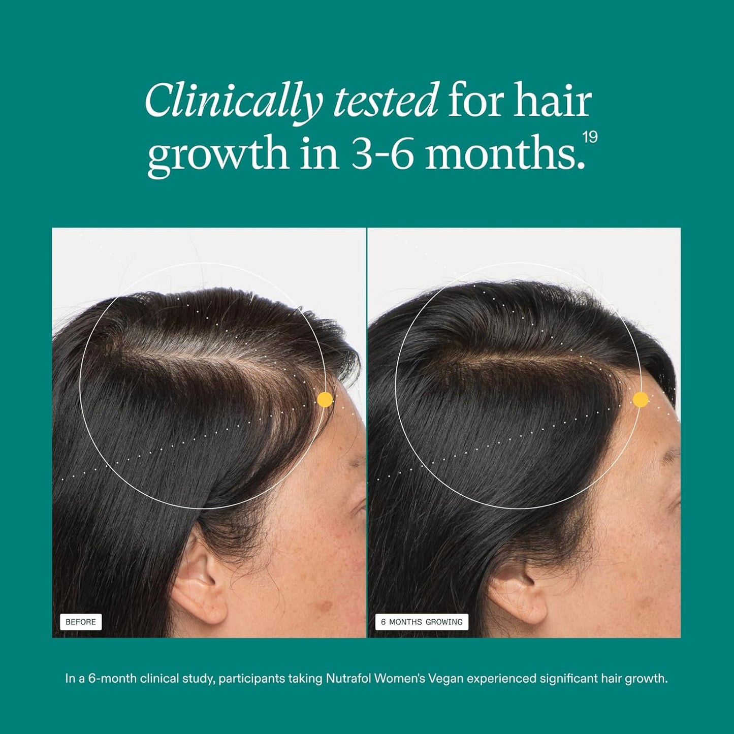 Nutrafol Women's Vegan Hair Growth Supplement